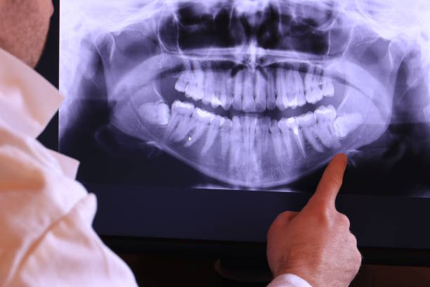 Best Emergency Dental Surgery in Commerce, OK