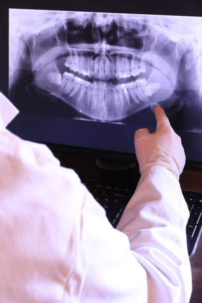 Best Emergency Tooth Extraction in Commerce, OK