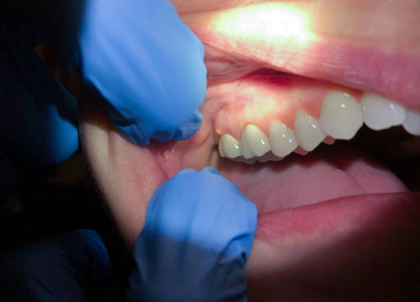 Best Emergency Orthodontic Repairs in Commerce, OK